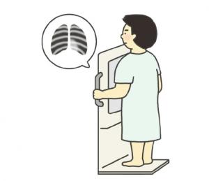 肺のレントゲン